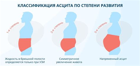 Физиологические причины дистензии брюшной полости у представительниц прекрасного пола