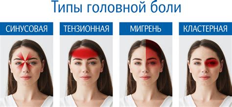Физиологический аспект головной боли