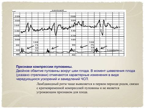 Физическое обследование в диагностике и изучении кардионевроза