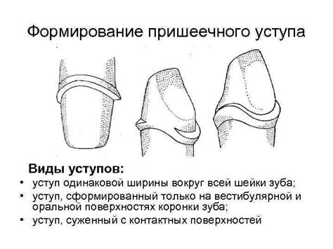Формирование шейки и ручки бульбика