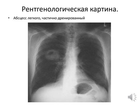 Хронические заболевания органов дыхания