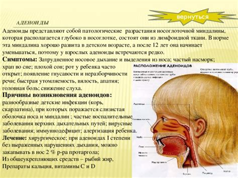 Частые заболевания вероятными признаками наличия аденоидов