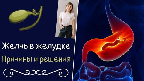 Частые факторы, вызывающие движение в желудке у женщин