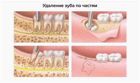 Что делать, если после удаления наклейки на стекле остались разводы и клей