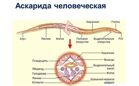 Что представляют собой анизакиды и как они попадают в организм человека
