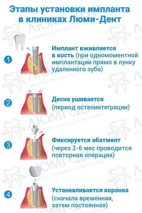 Этапы и рекомендации по завершению процесса установки