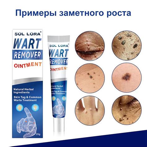 Эффективные и безопасные средства для удаления "хоботка" паразитных клещей в вашем жилище