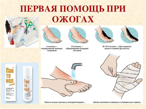 Эффективные методы для минимизации площади поражения и снижения боли при ожоге горячей водой