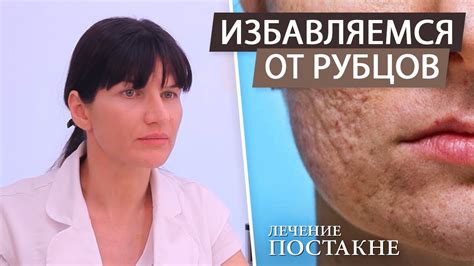 Эффективные методы и особенности лазерного удаления следов на коже