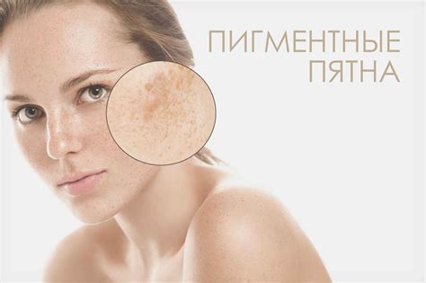 Эффективные методы удаления непигментированных областей на коже