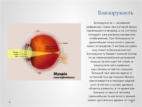 Эффекты постоянного напряжения глаз и перенапряжения зрения