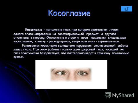  Биологический феномен: автоматическое отклонение глаз в сторону