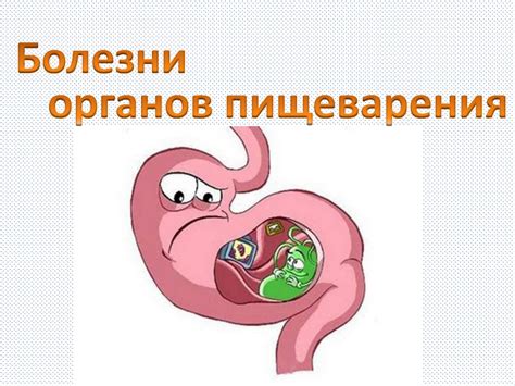  Болезни органов пищеварения 