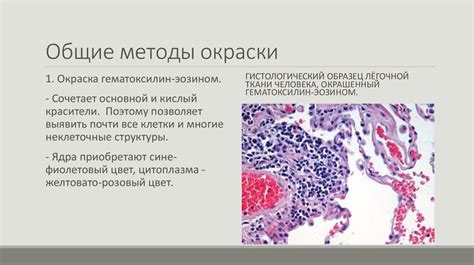  Влияние методов фиксации на эффективность окрашивания микробов 
