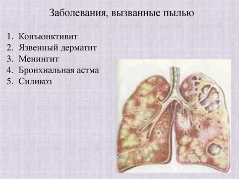  Влияние пыли на состояние здоровья 