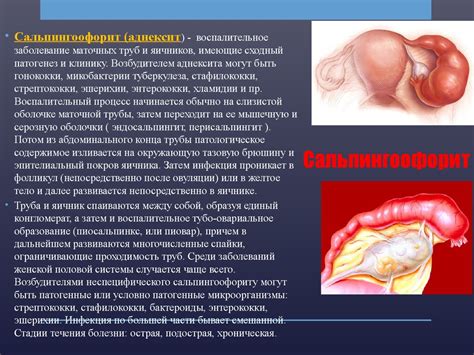 Воспалительные заболевания и их связь с текучими темно-коричневыми выделениями 
