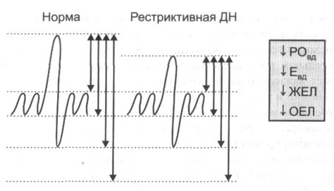  Гипервентиляция 