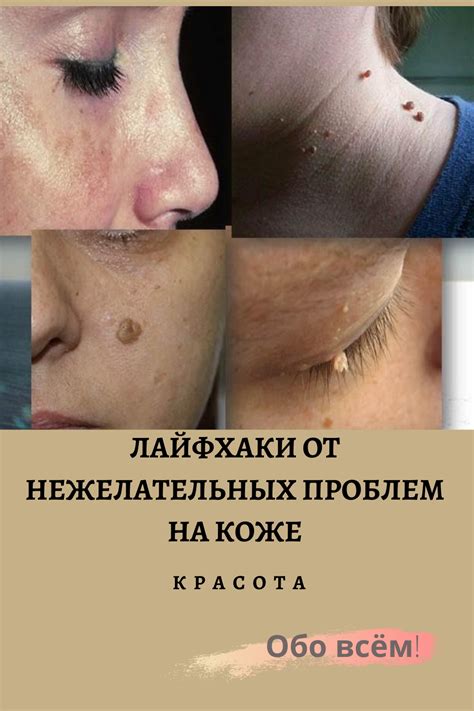  Популярные народные средства для избавления от нежелательных оттенков на коже 