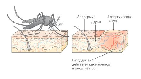  Симптомы аллергической реакции при укусе насекомого
