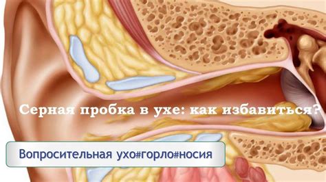  Что такое гной в ушах 