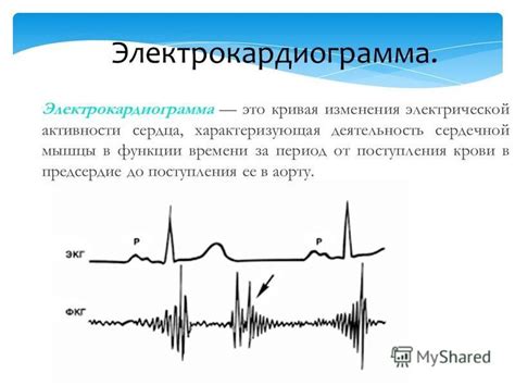 Электрокардиограмма: измерение сердечной активности и выявление аномалий