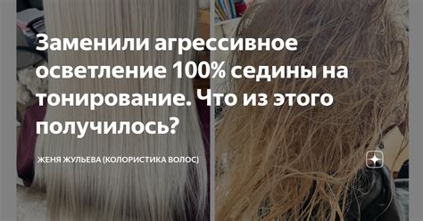 Агрессивное удаление волос