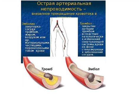 Алкоголь и расширение периферических сосудов