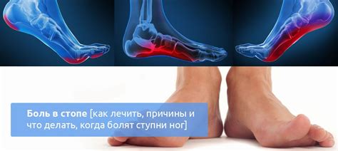 Алкоголь и судороги в ногах: связь и взаимодействие