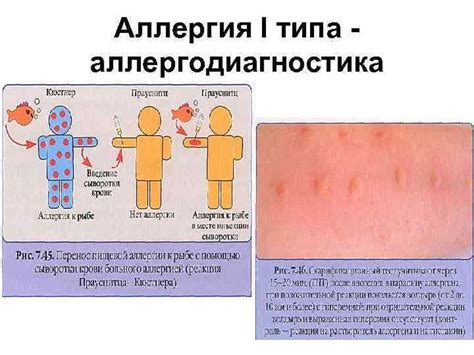 Альтернативные варианты лечения аллергических реакций у малышей