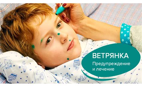 Альтернативные средства для лечения ветрянки у детей