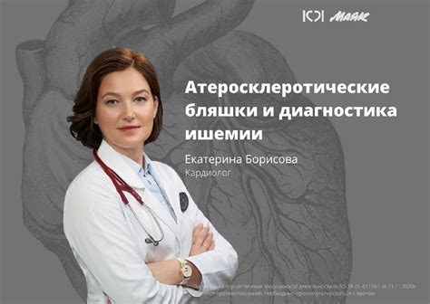 Атеросклеротические бляшки: их поиск и диагностика