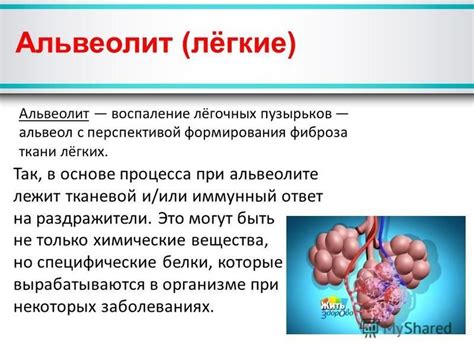 Бронхиолит и пневмония