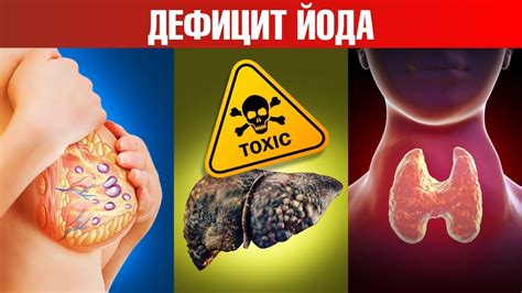 Важность йода для общего состояния организма
