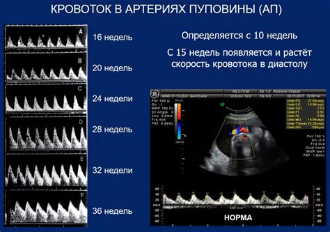 Важность определения правильного срока для обертывания пуповины