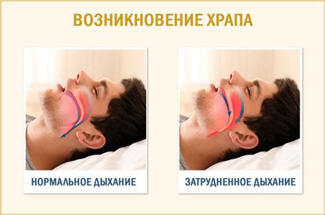 Важность правильного положения головы для сонных апноэ