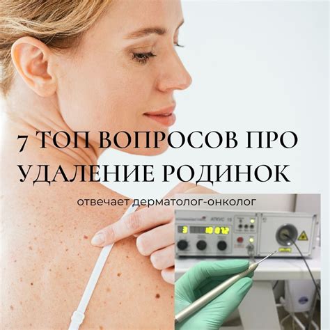 Важность проведения удаления родинок