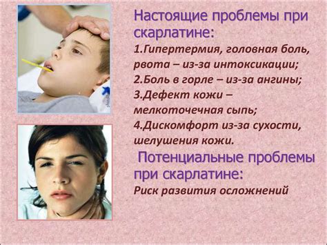 Важность умывания и смены одежды после гуляния при скарлатине