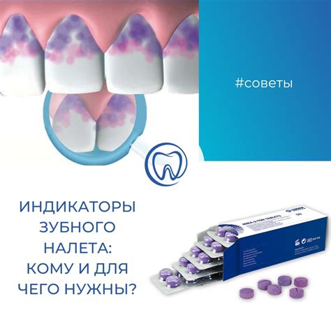 Важно знать: после удаления зубного налета можно пить воду, но с учетом онлайн-рекомендаций