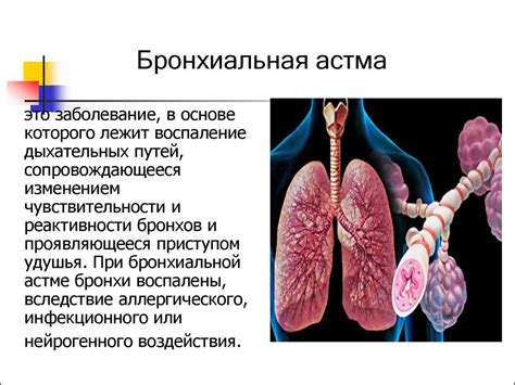 Важные моменты при приеме аспирина пациентами с астмой