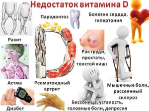 Витамин D при болезни