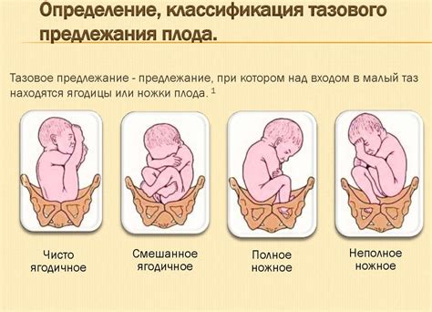 Влияние позы плода