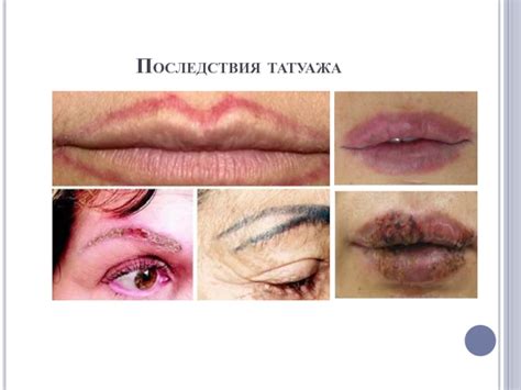 Влияние татуажа на ГВ