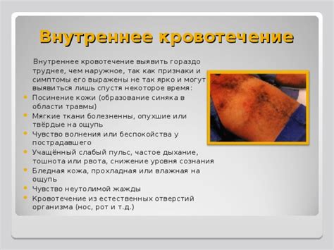 Внутреннее кровотечение: причины и последствия
