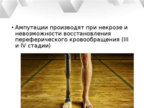 Возможность восстановления после ампутации: критерии и сроки