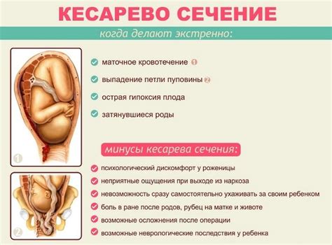 Возможность естественного родоразрешения после предыдущего кесарева сечения