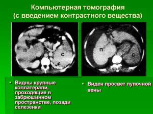 Возможные альтернативы КТ с контрастным веществом