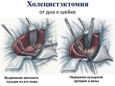 Возможные осложнения и последствия хирургического вмешательства