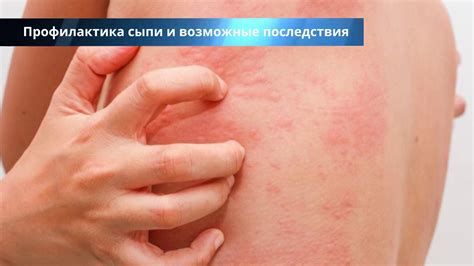Возможные последствия неправильного ухода за головой при крапивнице