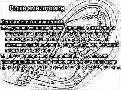 Возможные последствия прокола пузыря без схваток