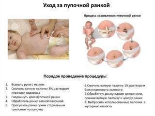 Возможные причины гноения пупка